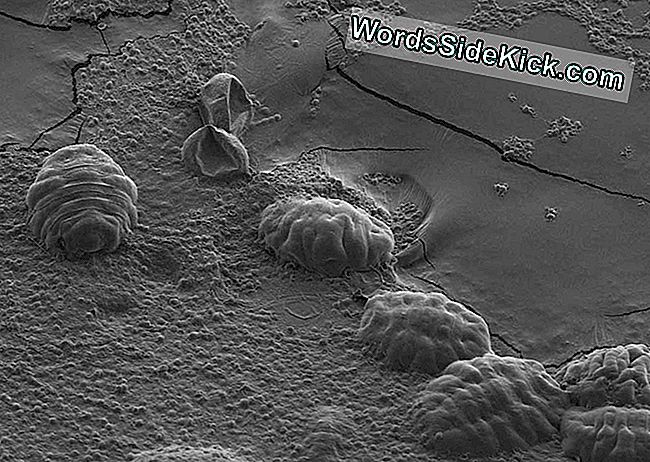 Sleutel Tot De 'Superkrachten' Van Tardigrades Geïdentificeerd In Hun Dna