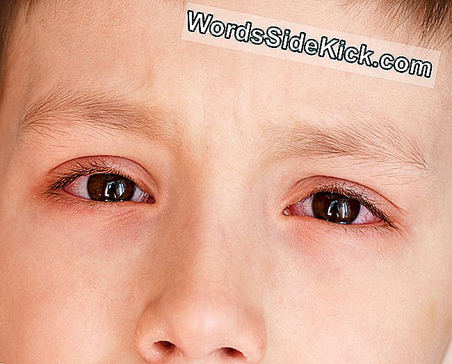 Pink Eye (Conjunctivitis): Oorzaken, Symptomen & Behandeling