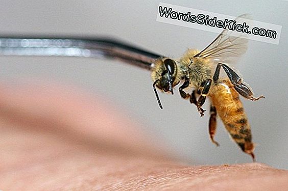 Live Bee Sting 'Acupuncture' Triggert Dodelijke Allergische Reactie