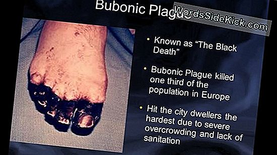 Teen Dies Of Plague: What Are The Symptoms Of The Deadly Disease?