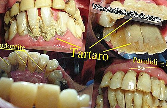 Candeggina Vs. Batteri: Come Fa Il Corpo A Pulire La Primavera