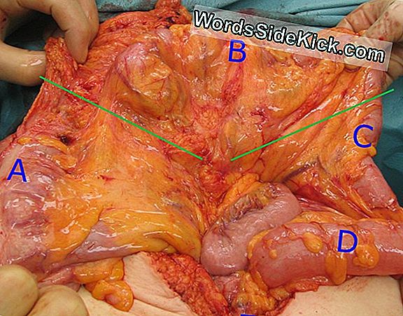 Blinde Hond Ziet Na Chirurgie