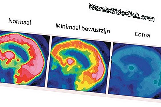 De Hersenen Herspannen Om De Controle Na De Slag Te Herwinnen