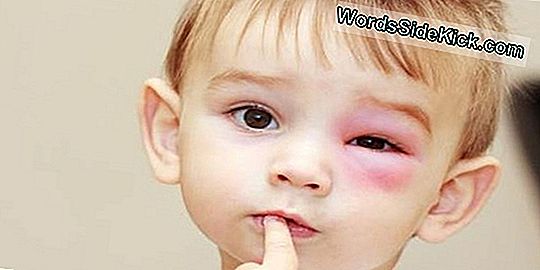 Laundry Pods And Kids: Eye Injuries On The Rise