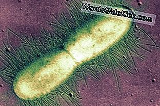 Een E. coli-bacterie wordt gevangen in de vroege stadia van binaire splitsing of splitsen in twee identieke cellen.