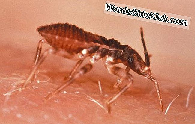 Chagas-Krankheit Gegen Aids: 6 Unterschiede Und 5 Ähnlichkeiten