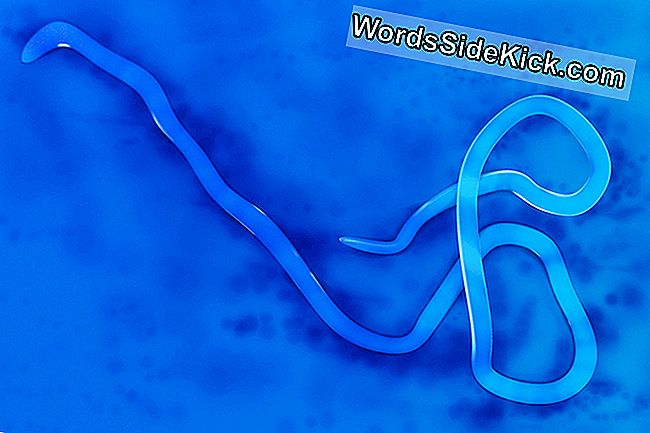 エボラは生存者の目の中にユニークな傷跡を残す