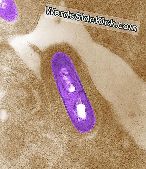 Listeria Enfeksiyonu: Belirtileri Ve Tedavisi