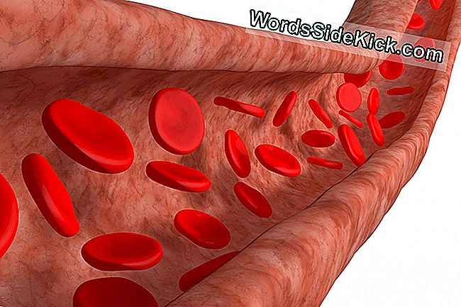 Sepsis: Nedenleri, Belirtileri Ve Tedavisi