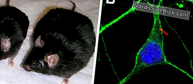 Paneel A toont een zwaarlijvige muis die zijn cilia heeft verloren door de hersenen aan de rechterkant en een normale nestgenoot aan de linkerkant. Paneel B toont een hersencel (groen omlijnd) met een cilium met de MCH-receptor in rood.