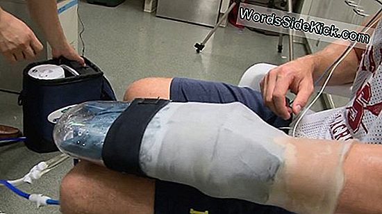 Cooling Glove 'Better Than Steroids' Geeft Sporters Een Handje