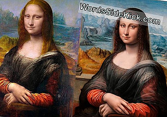 El Encanto De 'Mona Lisa': ¿Podría Ser El Resultado De La Enfermedad De La Tiroides?