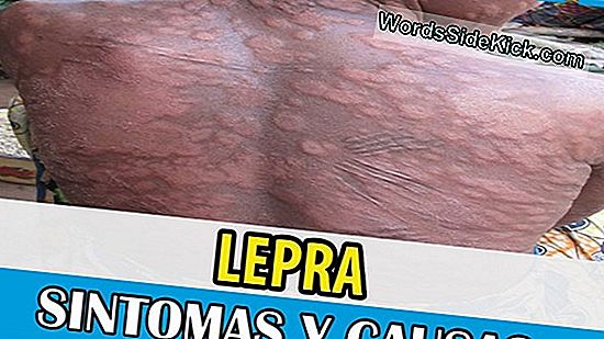 Lepra: Causas, Síntomas Y Tratamiento