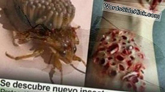 Las Llagas Dolorosas De La Mujer No Son Las Picaduras De Insectos, Sino Los Insectos Excavadores