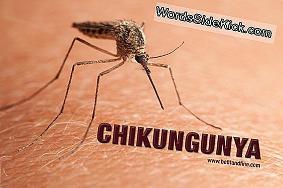 Chikungunya Palavik: Kas Viirus Levib Usa-Sse?