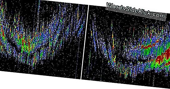 Mystery Of Bizarre Radar Echoes Solved, 50 Years Later