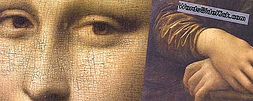 L'Attrait De La «Mona Lisa»: Pourrait-Il Être Le Résultat D'Une Maladie Thyroïdienne?