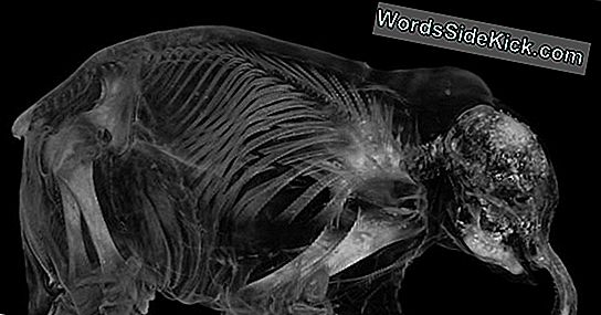 Baby Mammoth Innards Revealed In X-Ray Images