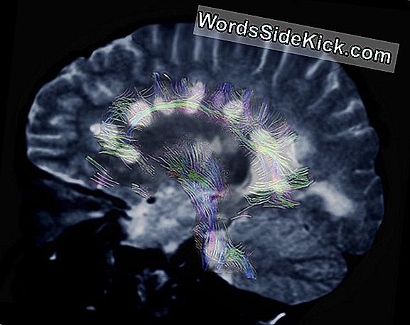 E Il Verdetto È...? Brain Scans Potrebbe Rivelare Intenzioni Criminali