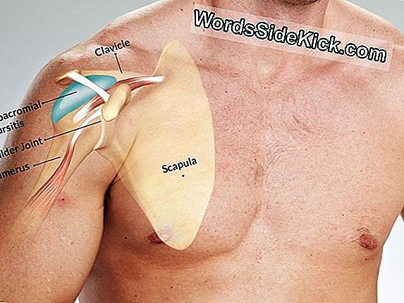 Is Bursitis Leeftijdsgebonden?