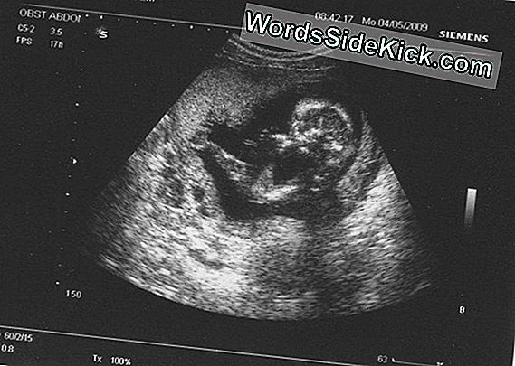 Niet Nodig Om Te Vertragen Zwanger Worden Na Een Miskraam, Stelt De Studie Voor