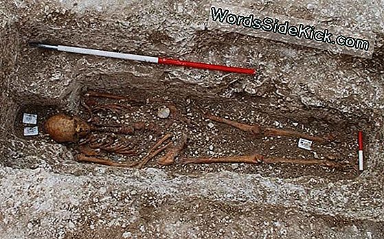 Pilgrim'S Burial: Medieval Man With Leprosy Honored At Death