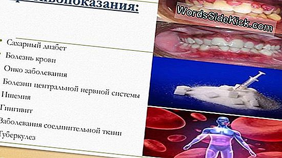 Окрашенные Человеческие Челюсти Используются Как Древние Украшения