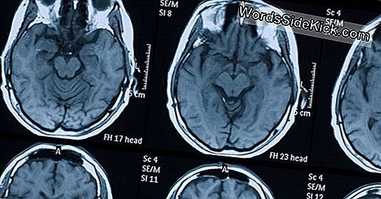Beyin Yaralanmaları: Belirsiz Recoveries Yapbozunu Çözme