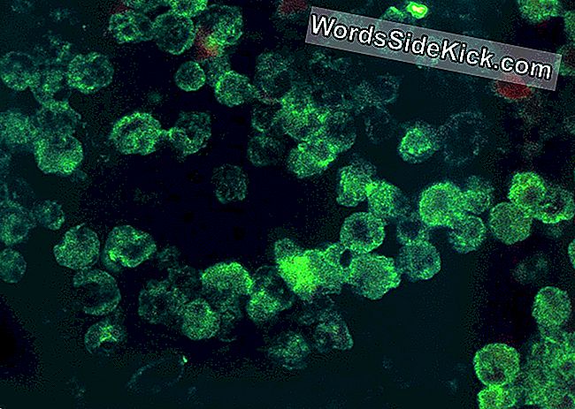 See pilt näitab ameeriklaste Naegleria kanaari nakatumist mikroskoobi all ja värvitakse fluorestsentsantikehaga.
